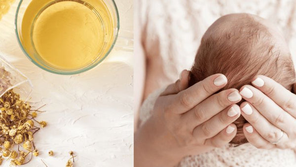 Cradle cap relief